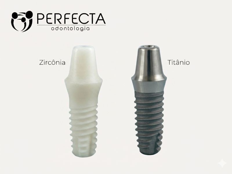 Implante de Titânio vs Zircônia: Qual a Diferença e Por Que Isso Importa para o seu Sorriso