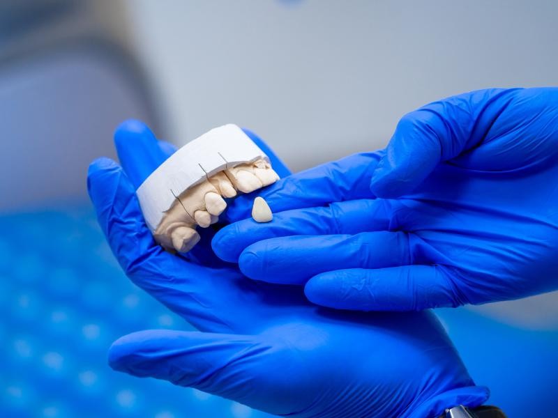 Prótese de Porcelana