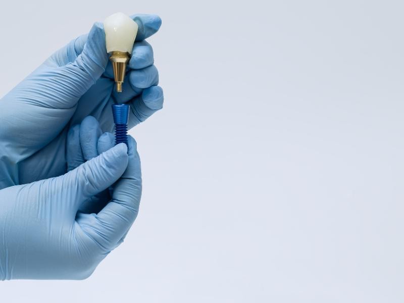 Prótese sobre Implante